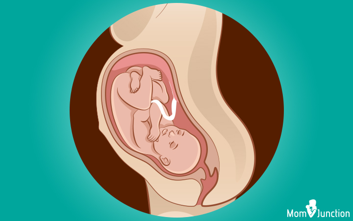 Cephalic Position: Understanding Your Baby's Presentation at Birth