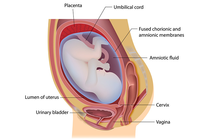 Effects of subchorionic haematoma on pregnancy outcomes - Australian  Medical Student Journal