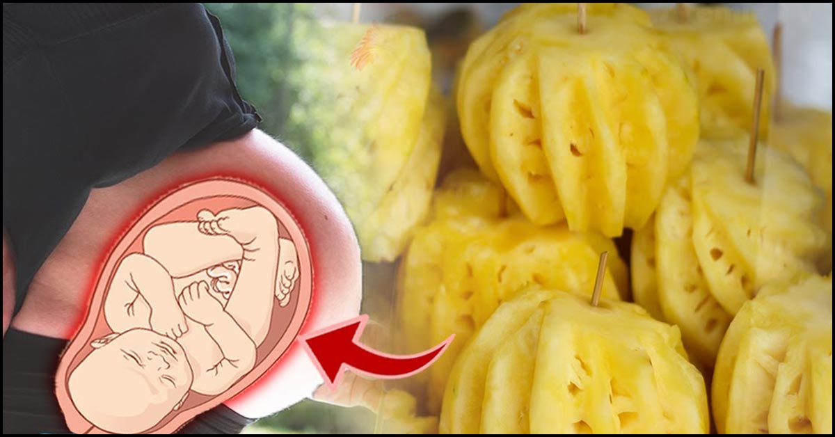 is-it-safe-to-eat-pineapple-during-pregnancy