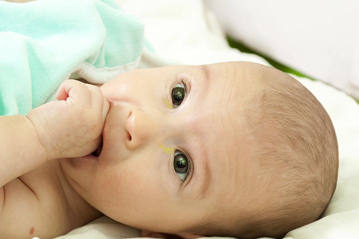 7-causes-of-sticky-eyes-in-newborn-babies-and-treatment