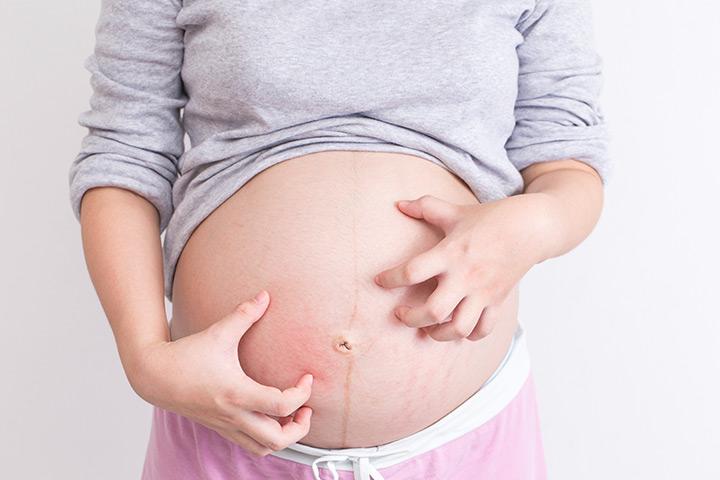 itchy-belly-during-pregnancy-causes-remedies-and-treatment