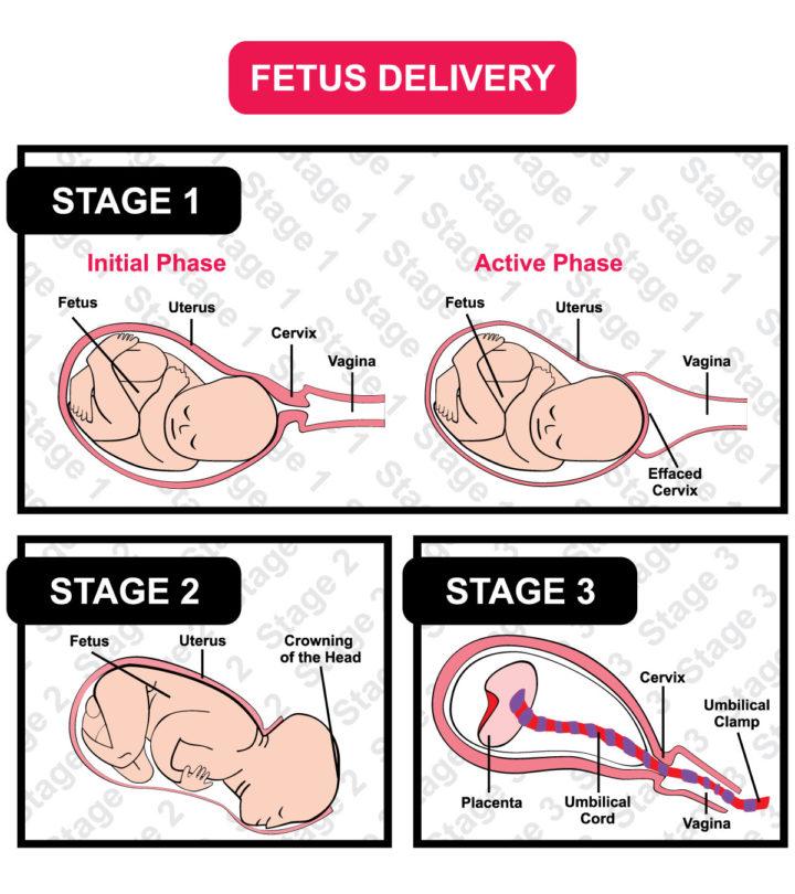 Retained Placenta: Causes, Symptoms, And Treatment