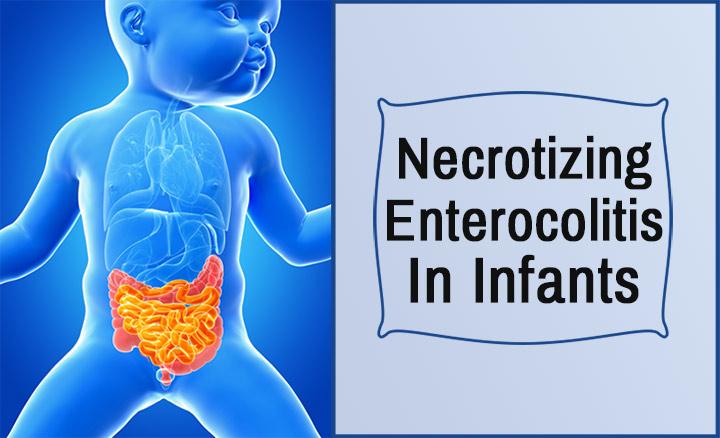 Necrotizing Enterocolitis Pathophysiology