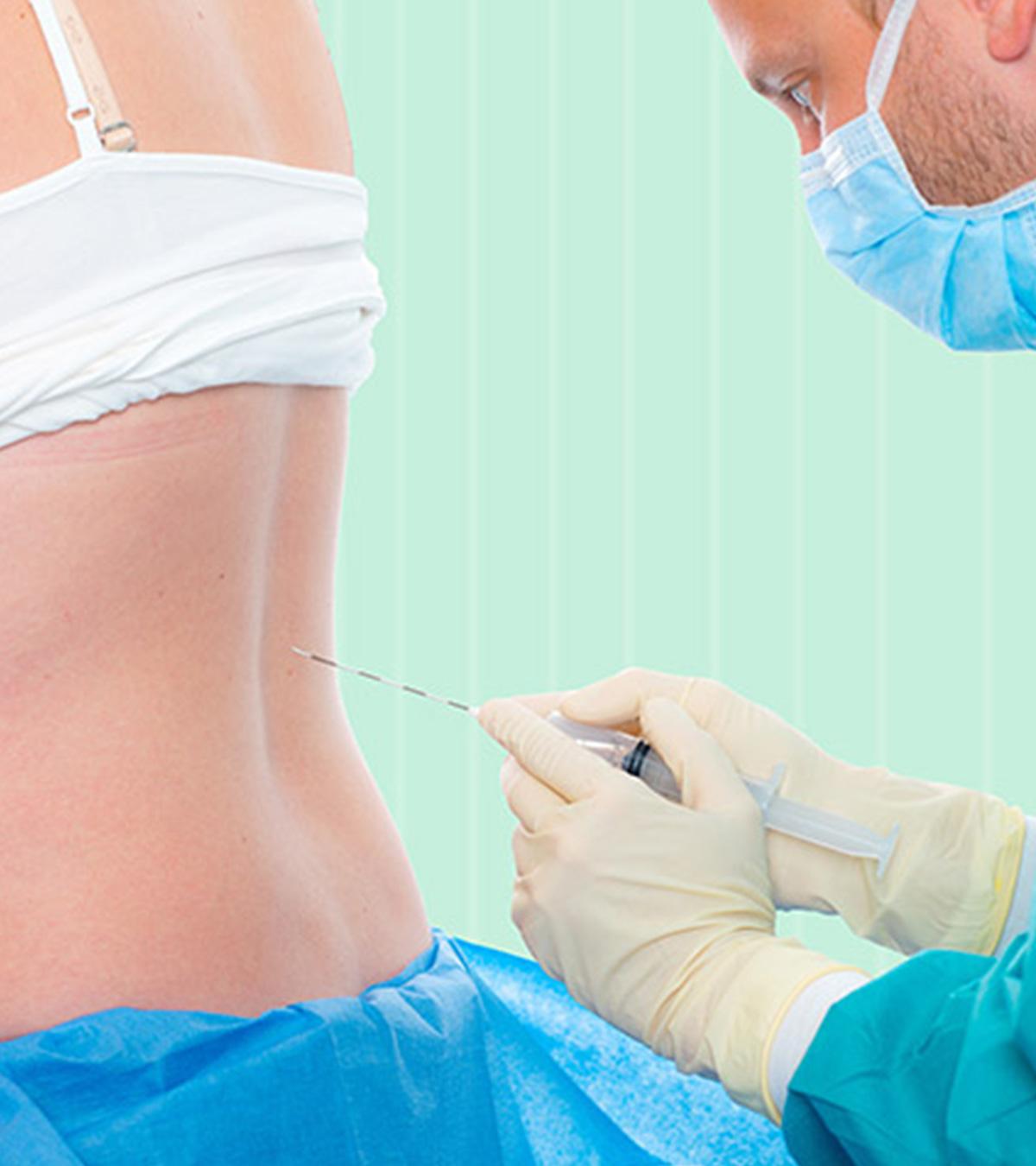 Moms Hub Epidural Injection For Pregnancy Cost