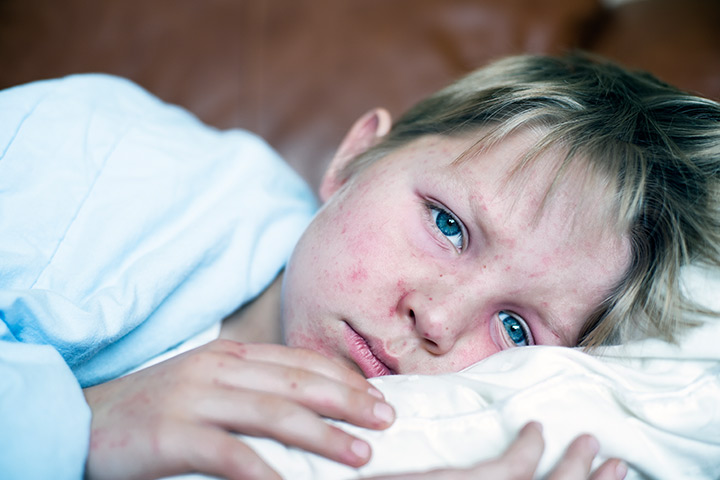 Skin Rashes in Children: Learn the Most Common Causes