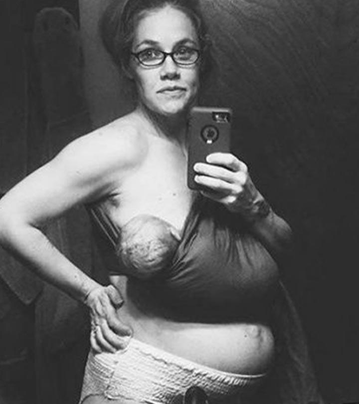 Mum’s Selfie Of Body 24 Hours After Birth Goes Viral