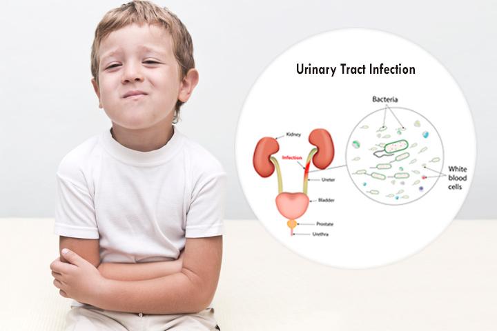 Urinary Tract Infection (UTI) In Children - Symptoms And Home Remedies