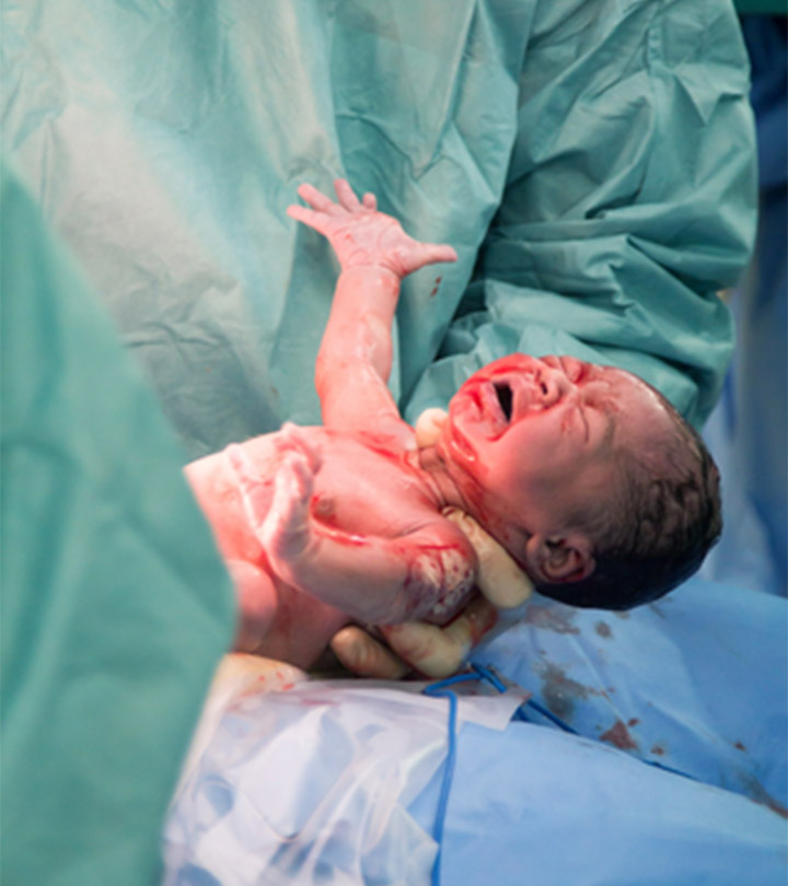 C-Section-Deliveries---How-They-Affect-The-Newborns