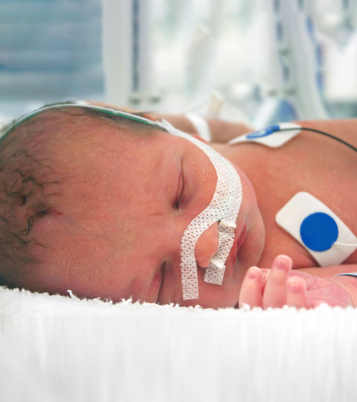 Video Of A Baby Born 3.5 Months Premature A Living Miracle