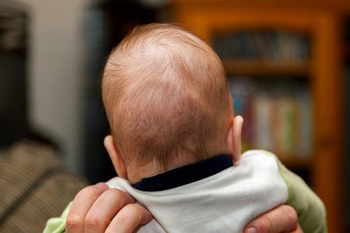 Home remedies for 2024 flat head baby