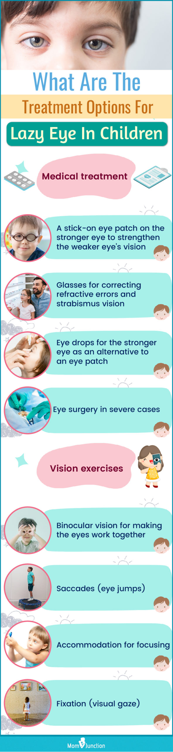 Lazy Eye (Amblyopia): Symptoms, Causes & Treatment