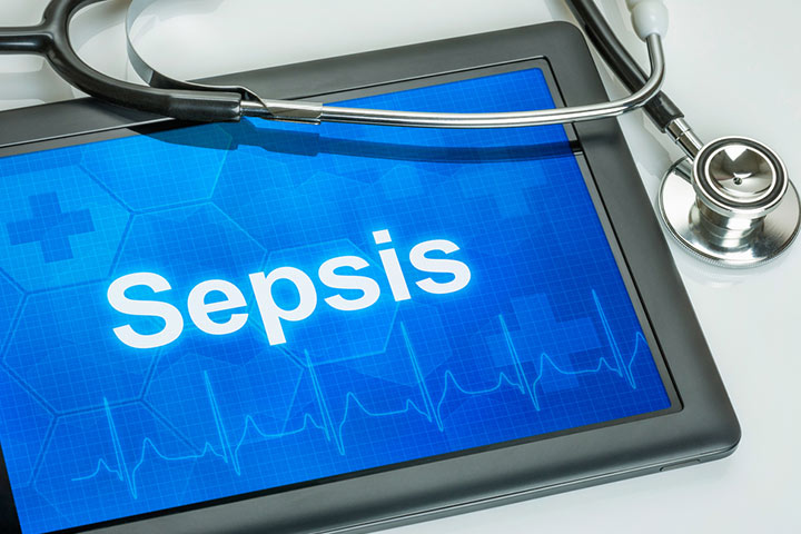 Sepsis In Babies: Causes, Symptoms, Diagnosis And Treatment