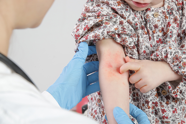 Staphylococcal Infections: MedlinePlus