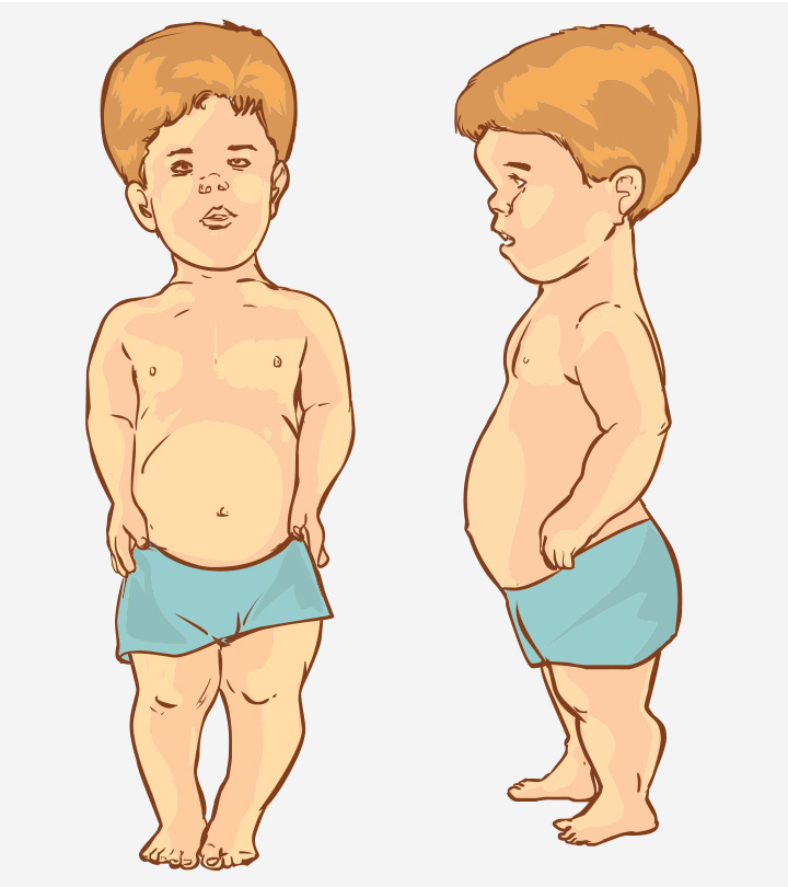 proportionate dwarfism toddler