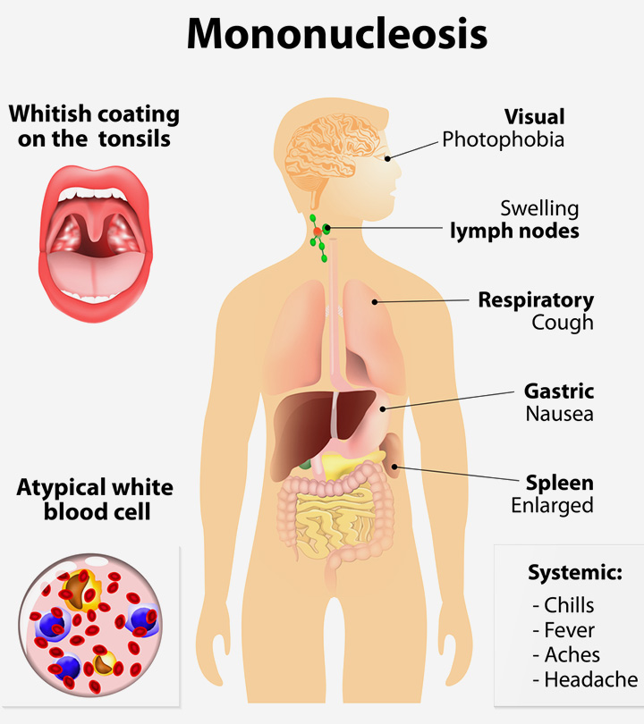 Does Mono Have a Long-Term Impact on the Immune System?