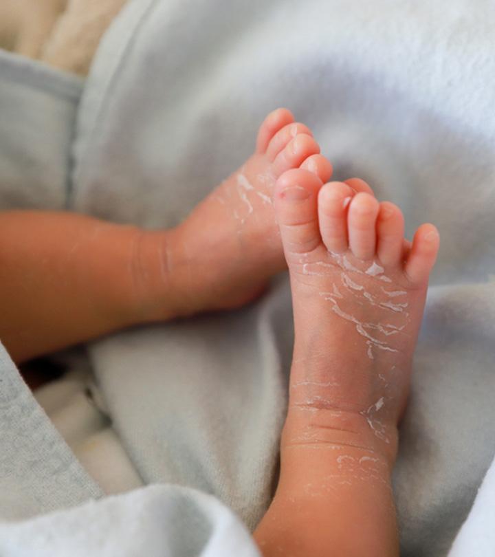 7 Common Skin Problems In Children