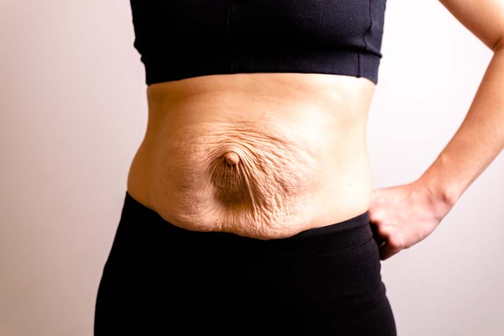 Healing Your Postpartum Belly Bulge