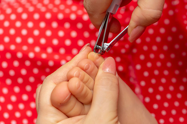 How To Prevent And Treat Your Baby's Ingrown Toenails - MVS Podiatry  Associates