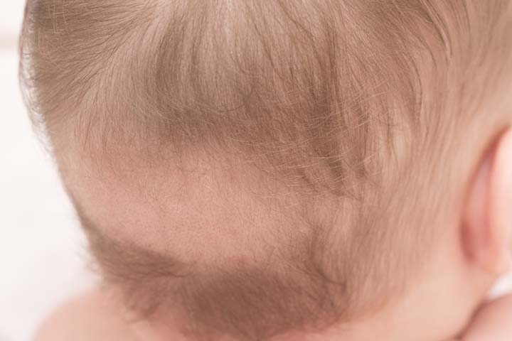 Baby Hair: Why It Falls Out and How to Help it Grow