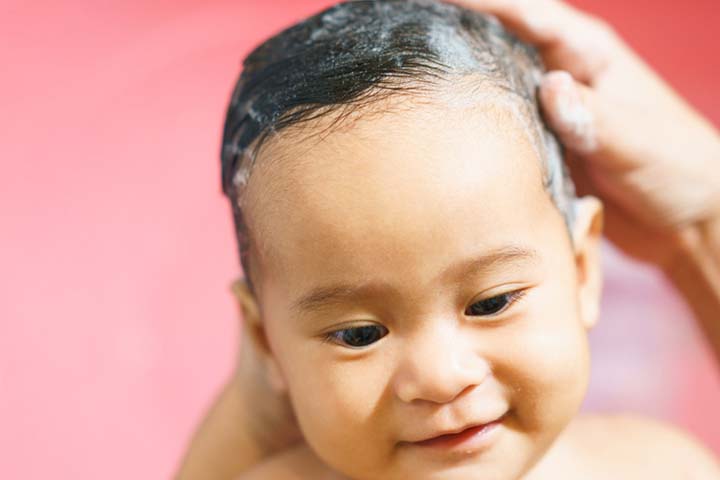 Hair Loss in Babies