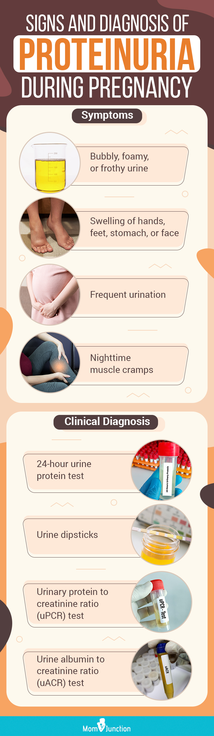 Signs And Diagnosis Of Proteinuria During Pregnancy 