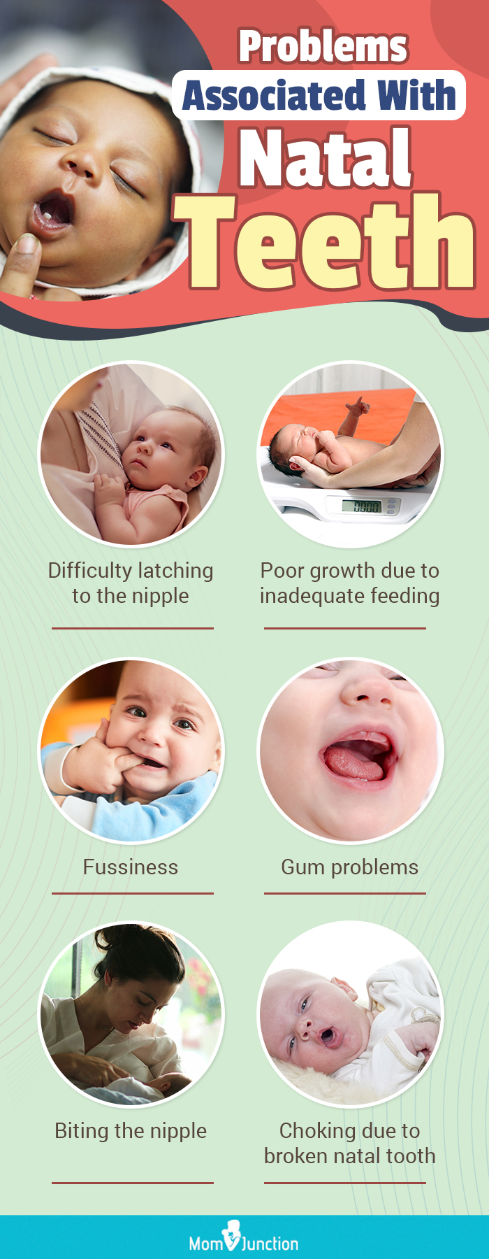 Problems Associated With Natal Teeth 