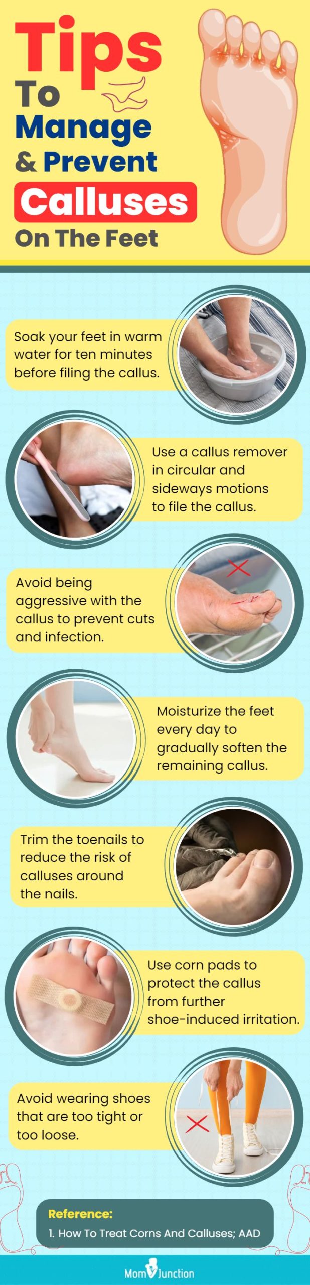 The Best Callus Remover—And Six Other Ways to Deal With Calluses on Your  Feet