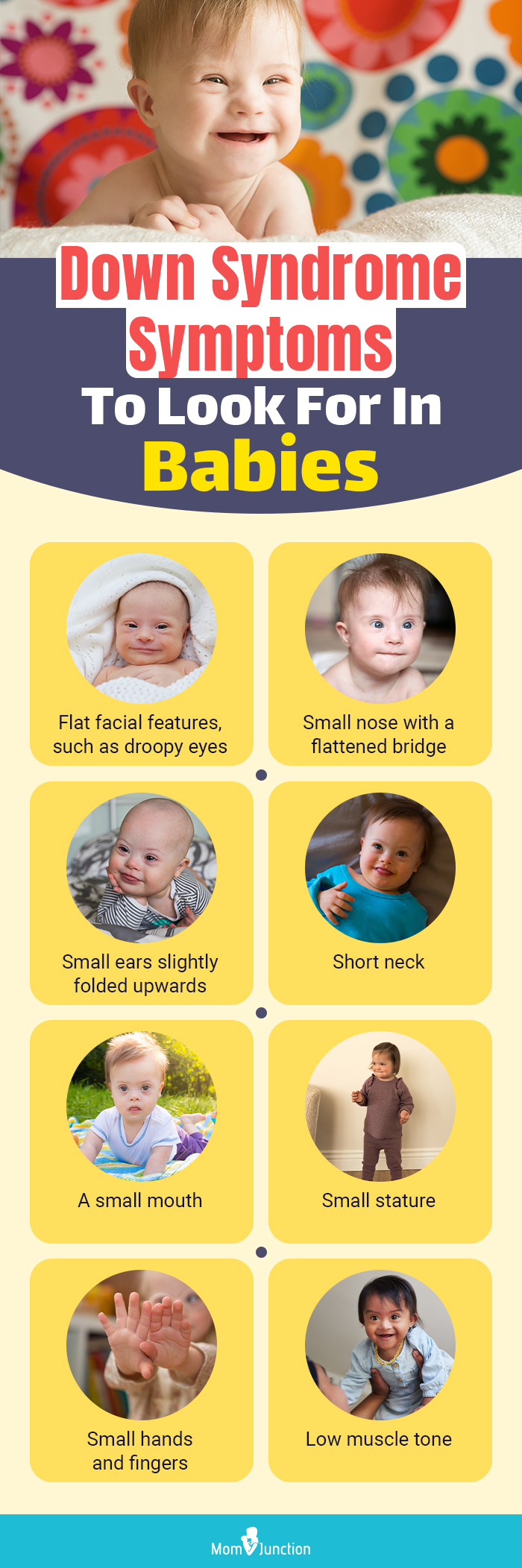 Down Syndrome Symptoms To Look For In Babies 